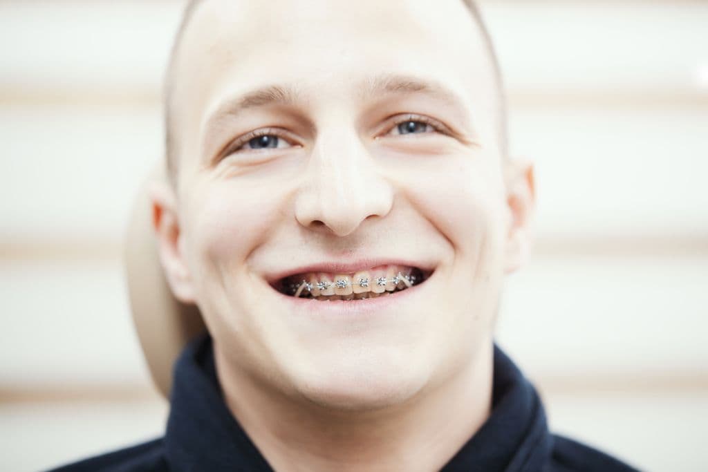 Protetyka-Perfecr-Smile-Clinic-01