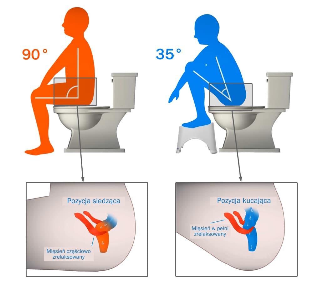 diagram_squatty_potty